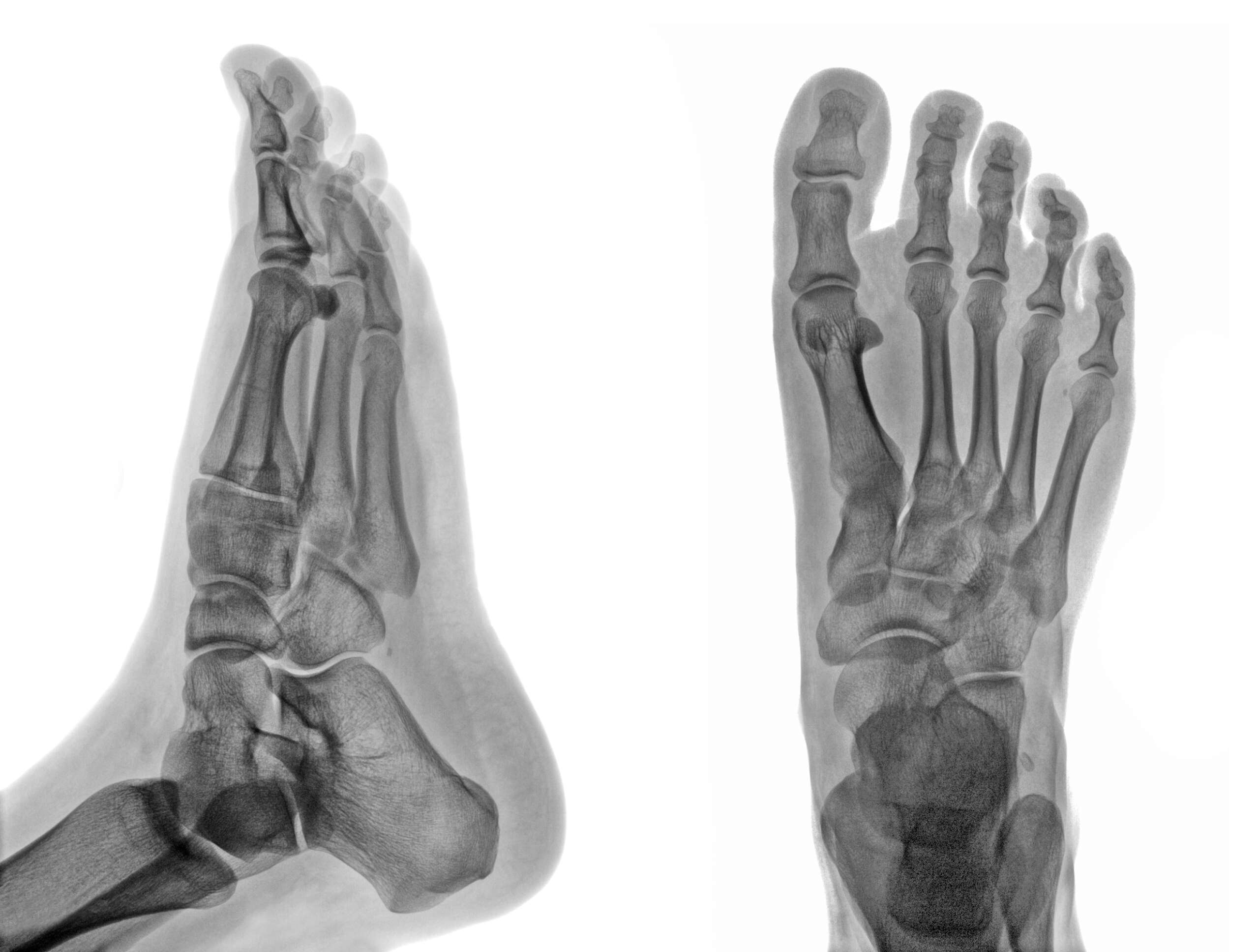 Radiographie pieds - Maison de Santé Pluridisciplinaire Fantaisie à Saint-Joseph Martinique